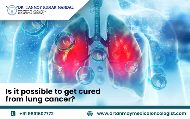 Is it possible to get cured from lung cancer : Says Lung Cancer Doctor