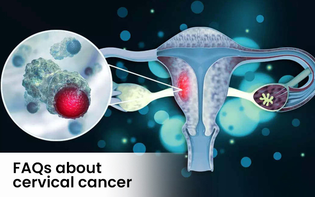 Cervical Cancer Guide