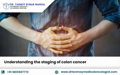 Understanding the staging of colon cancer 
