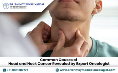 Common Causes of Head and Neck Cancer Revealed by Expert Oncologist