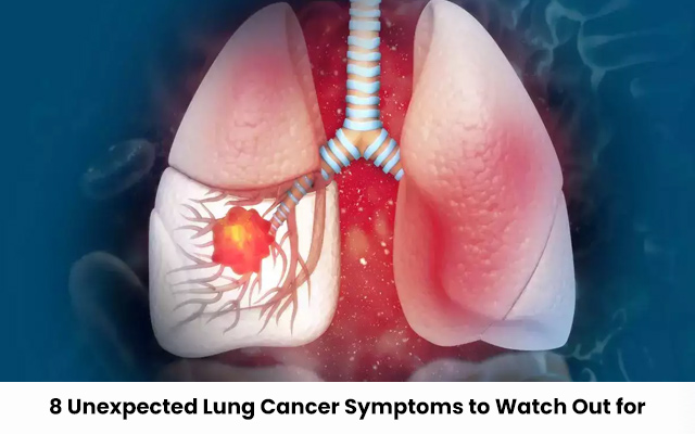 Lung cancer symptoms