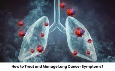 How to Treat and Manage Lung Cancer Symptoms?