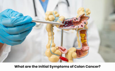 What are the Initial Symptoms of Colon Cancer?